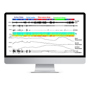 SleepScore