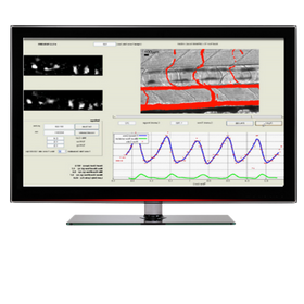 Zebrafish automatic measurement of cardiovascular features